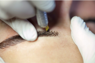 3D kıl tekniği (Microblading)